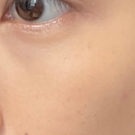 【旧】ディオールスキン フォーエヴァー スキン コレクト コンシーラー/Dior/リキッドコンシーラーを使ったクチコミ(4枚目)