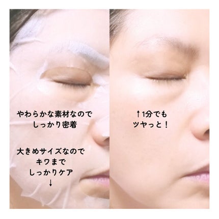 レッドブレミッシュクイックPHAシートマスク/Dr.G/シートマスク・パックを使ったクチコミ(4枚目)