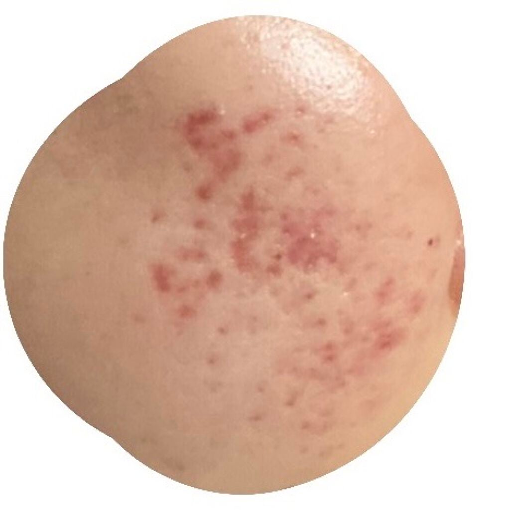 ハトムギ化粧水(ナチュリエ スキンコンディショナー R )/ナチュリエ/化粧水を使ったクチコミ(1枚目)