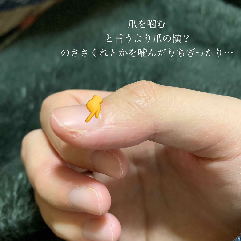 Dr Nail Daisoのネイル ネイルケアを使った口コミ 爪噛み癖 辞めます 綺麗な爪とか何もネイルしてなくてもとても綺麗で By あ ま と う 乾燥肌 10代後半 Lips