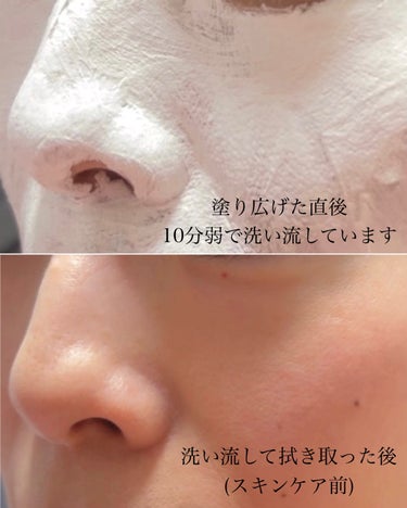 CCクリアフィットマスク/Shangpree/洗い流すパック・マスクを使ったクチコミ（8枚目）