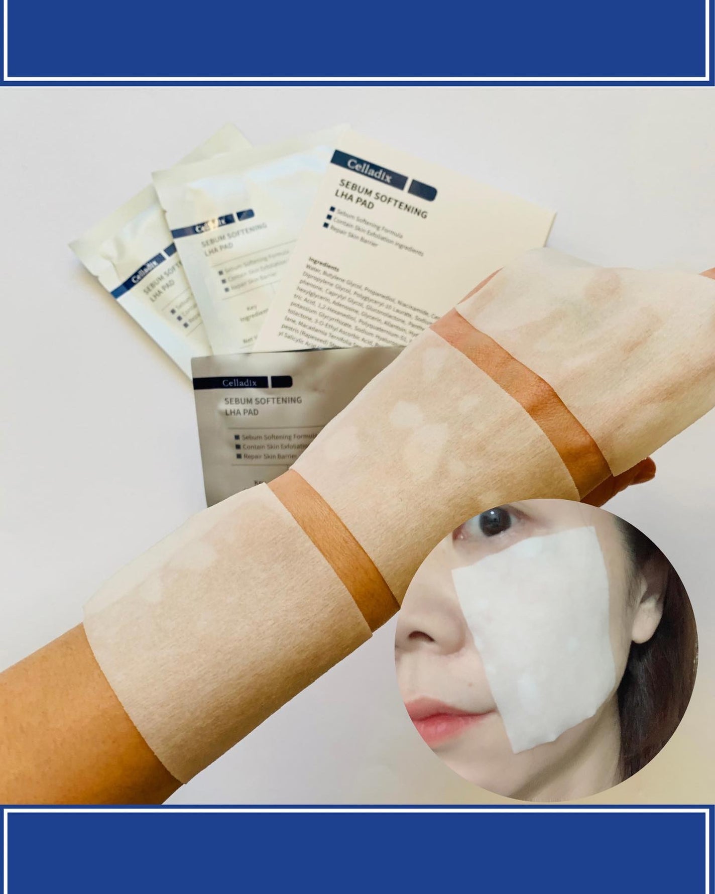 セバムソフトニング131LHAピーリングパッド/Celladix/トナーパッドを使ったクチコミ(4枚目)