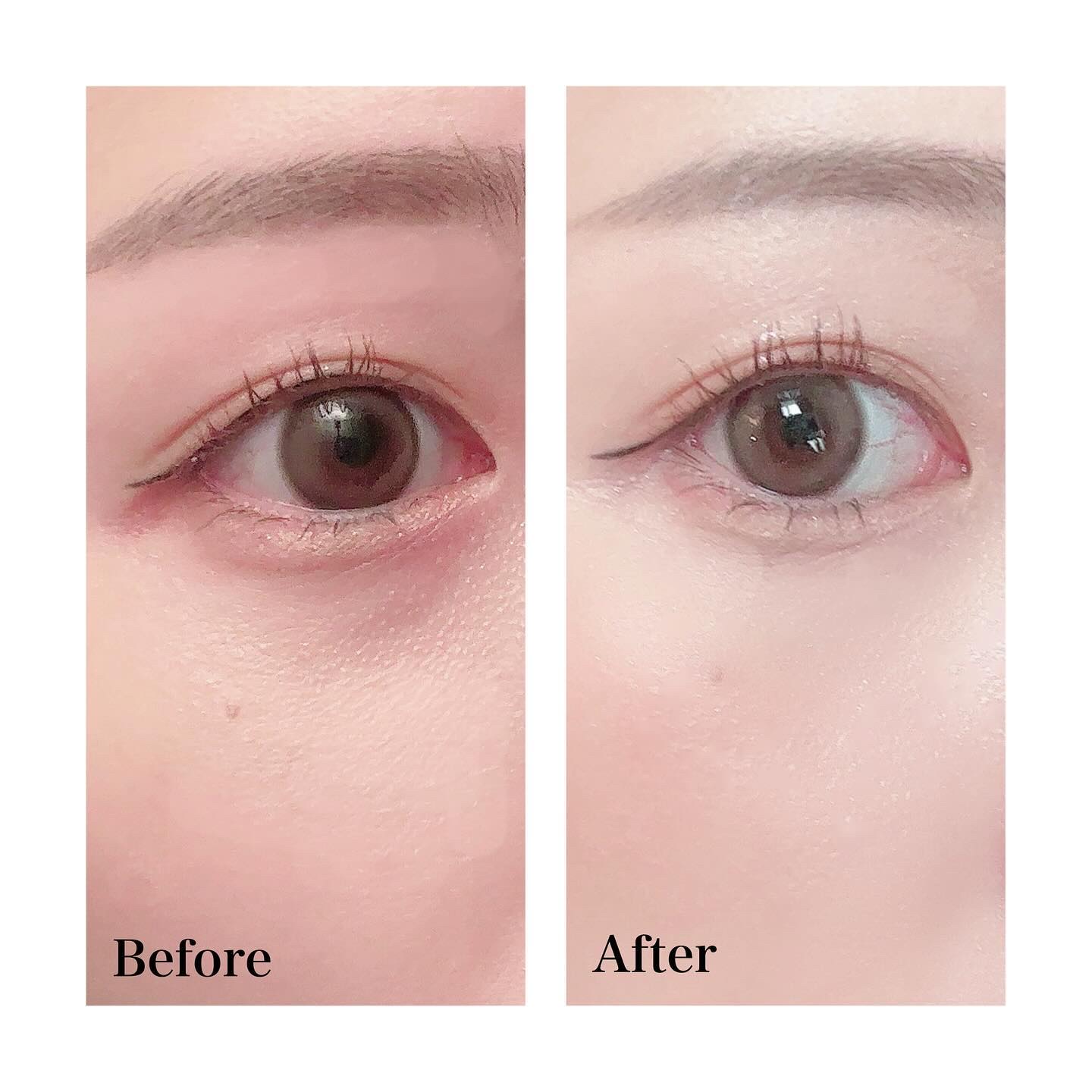 アイレノール クマクリーム/IRENOL/アイケア・アイクリームを使ったクチコミ（3枚目）