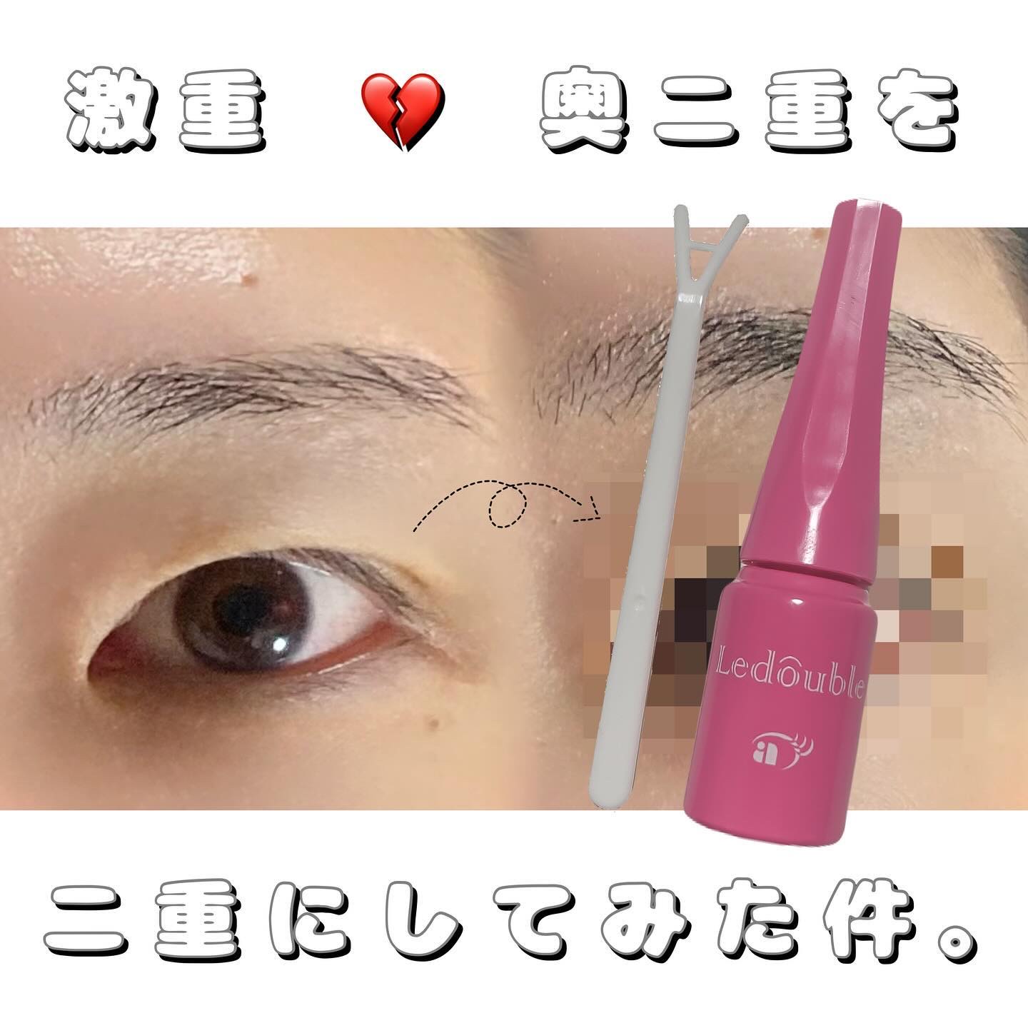 大人のルドゥーブル 大人のルドゥーブル4ml/ルドゥーブル/二重まぶた用アイテムを使ったクチコミ（1枚目）