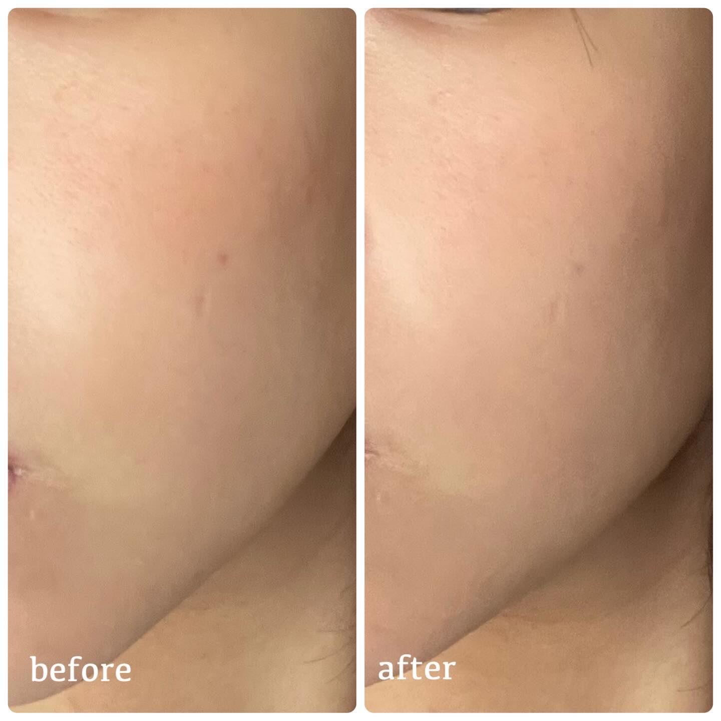 マーシュフィールド SC クリームファンデS 31/マーシュ・フィールド/クリーム・エマルジョンファンデーションを使ったクチコミ（2枚目）