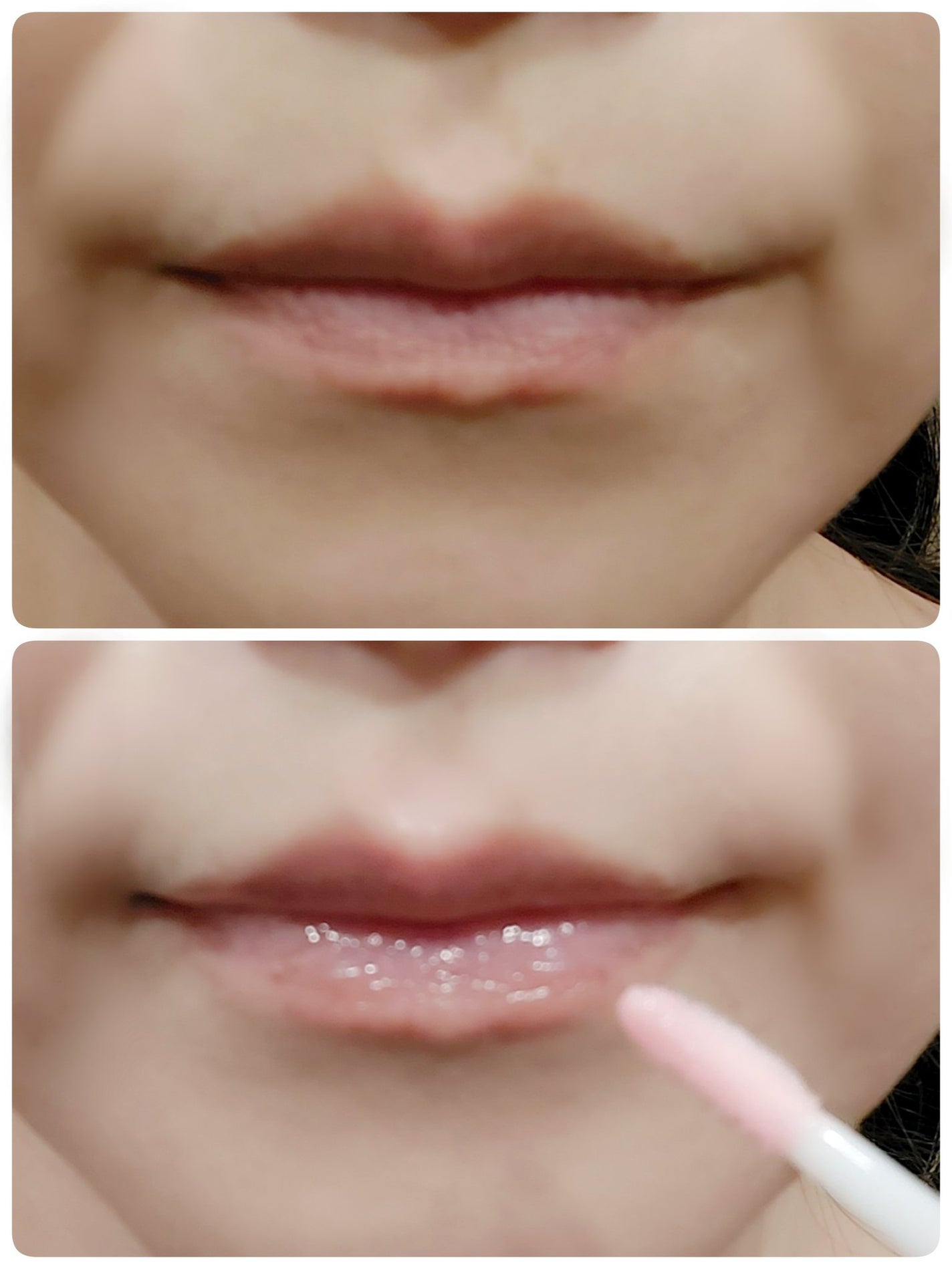 ニードルプランパー 高熱フィグ/Ui2./リッププランパーを使ったクチコミ(2枚目)