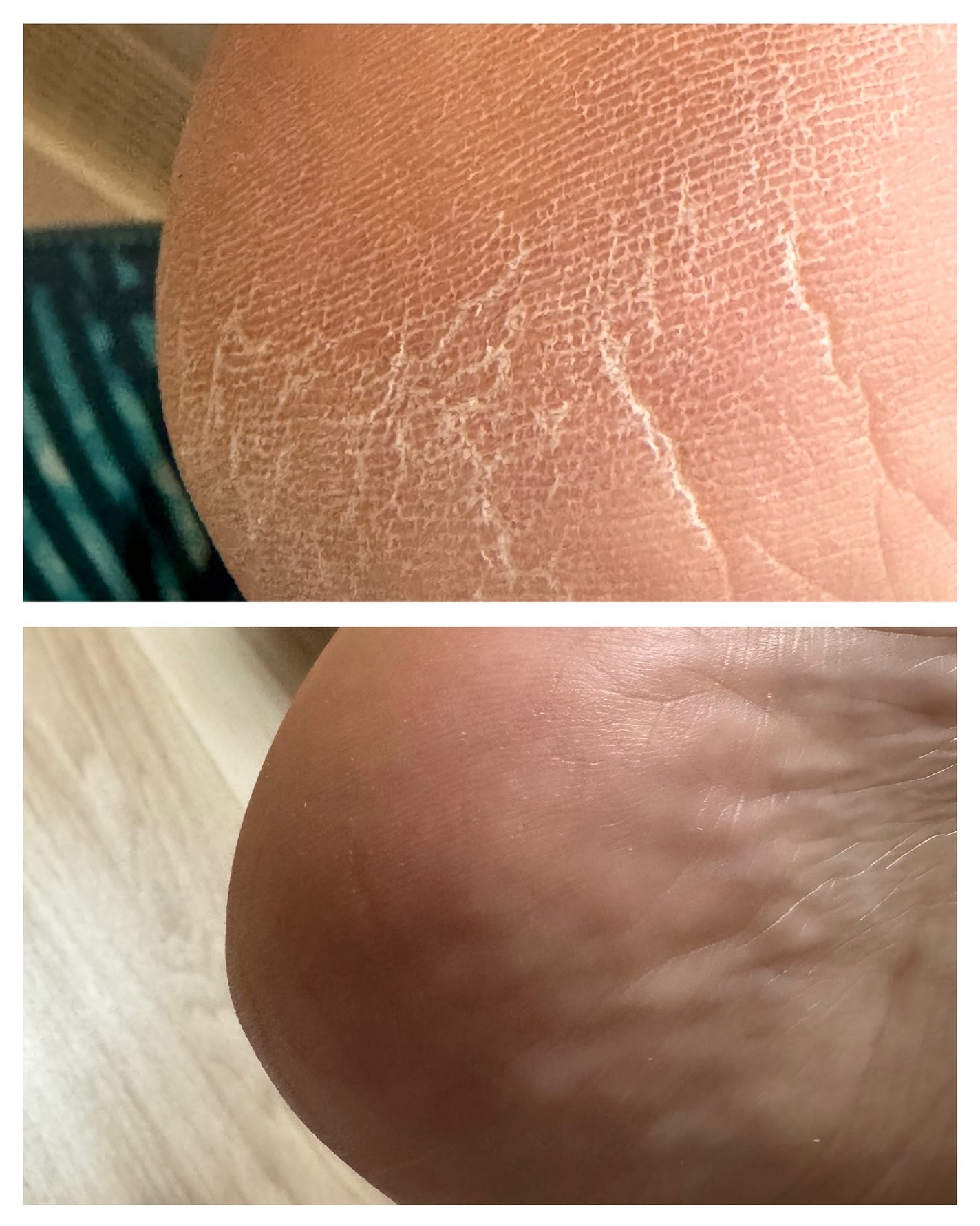 星野家の手作りマッサージ塩/星野家/ボディスクラブを使ったクチコミ(5枚目)