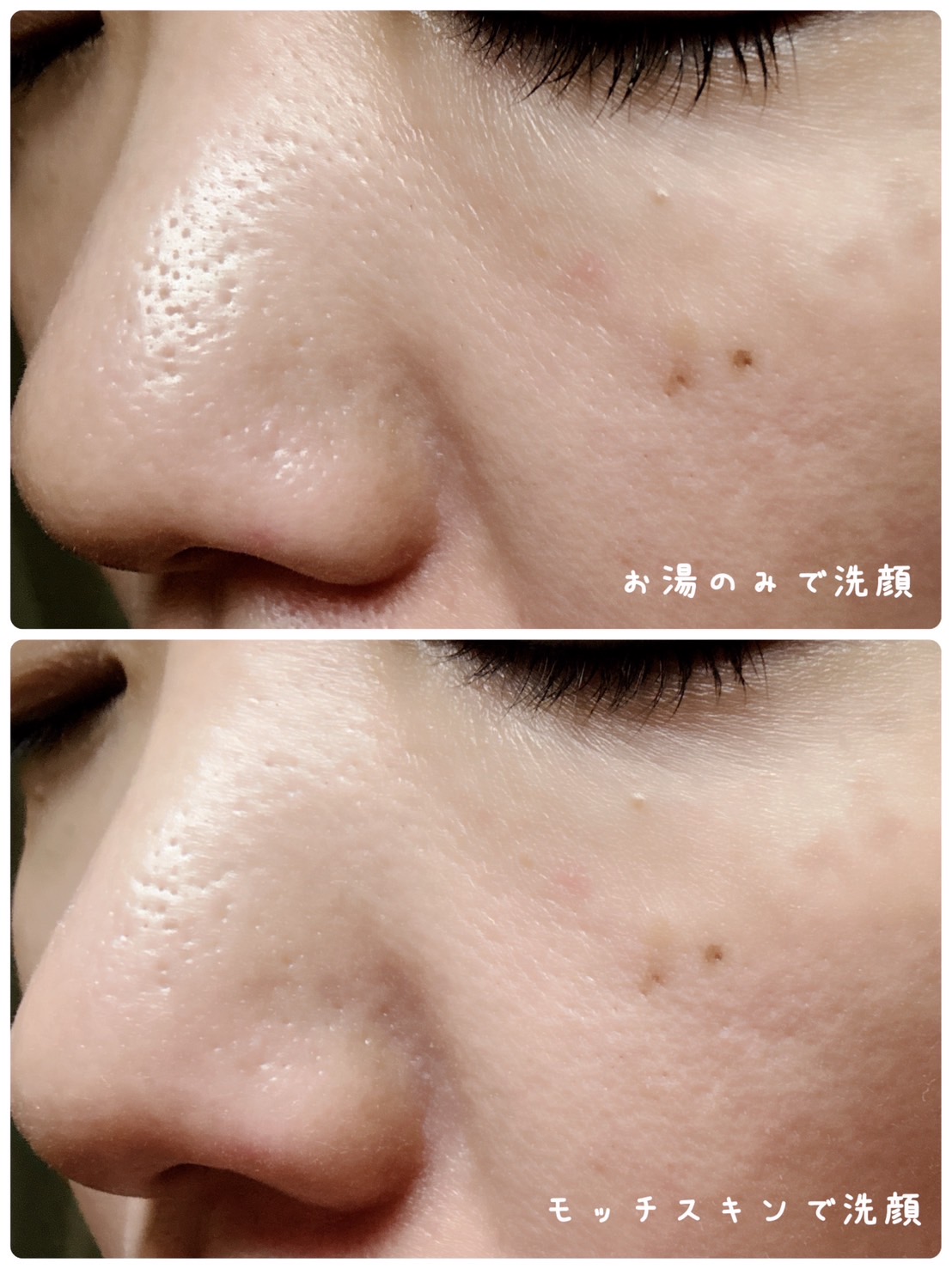 モッチスキン 吸着クレンジング WHT/MoccHi SKIN/クレンジングジェルを使ったクチコミ（3枚目）