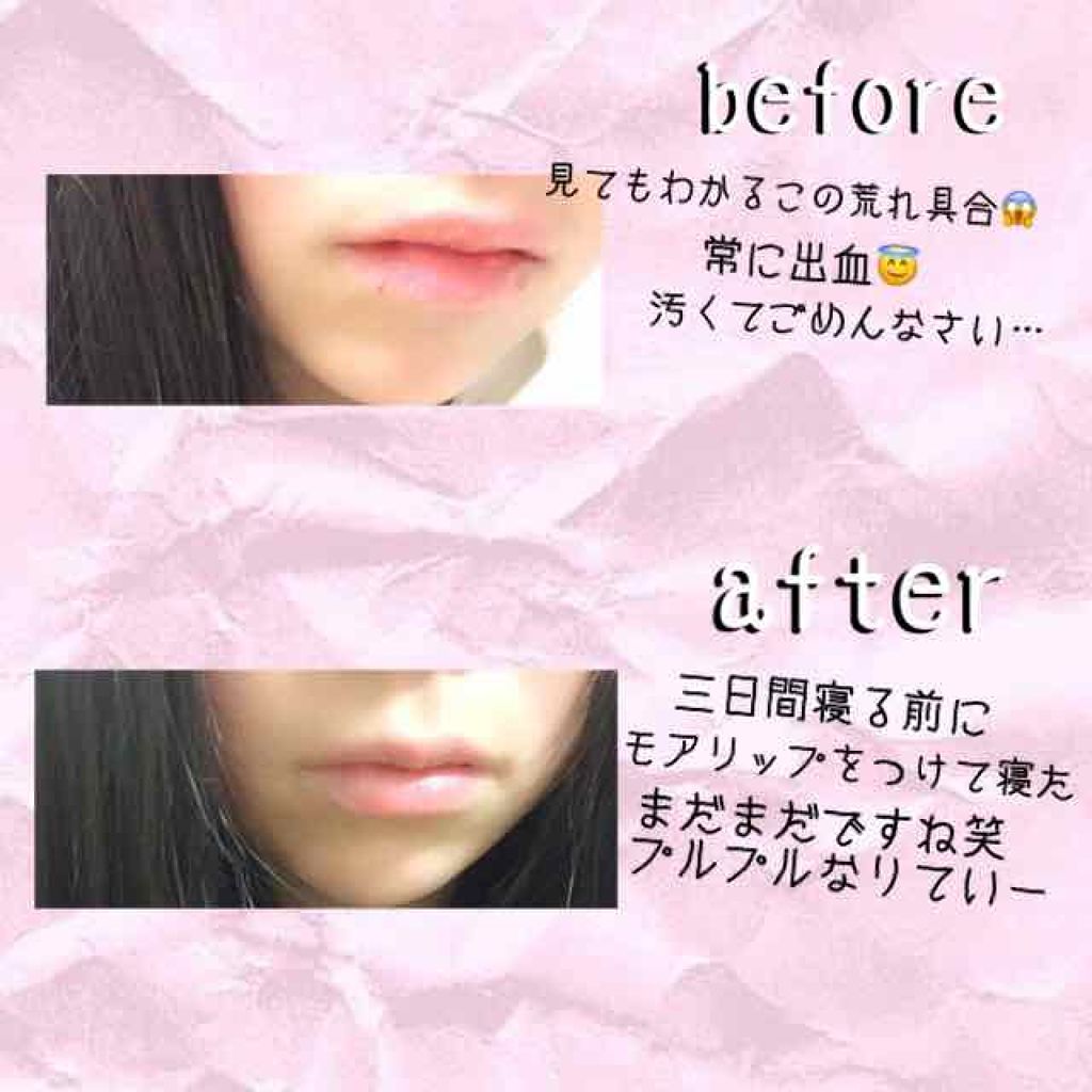 モアリップ N (医薬品)/資生堂薬品/その他を使ったクチコミ（3枚目）