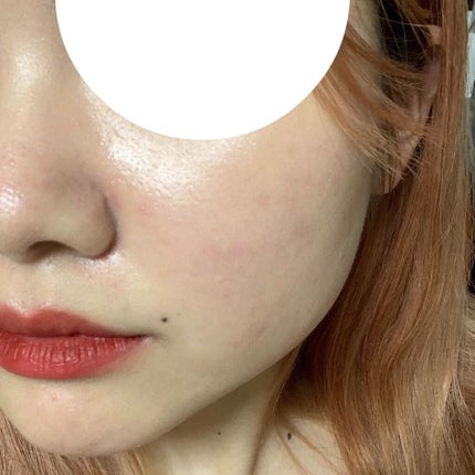 ティーツリーカーミングエッセンスパッド/MEDIHEAL/トナーパッドを使ったクチコミ(4枚目)