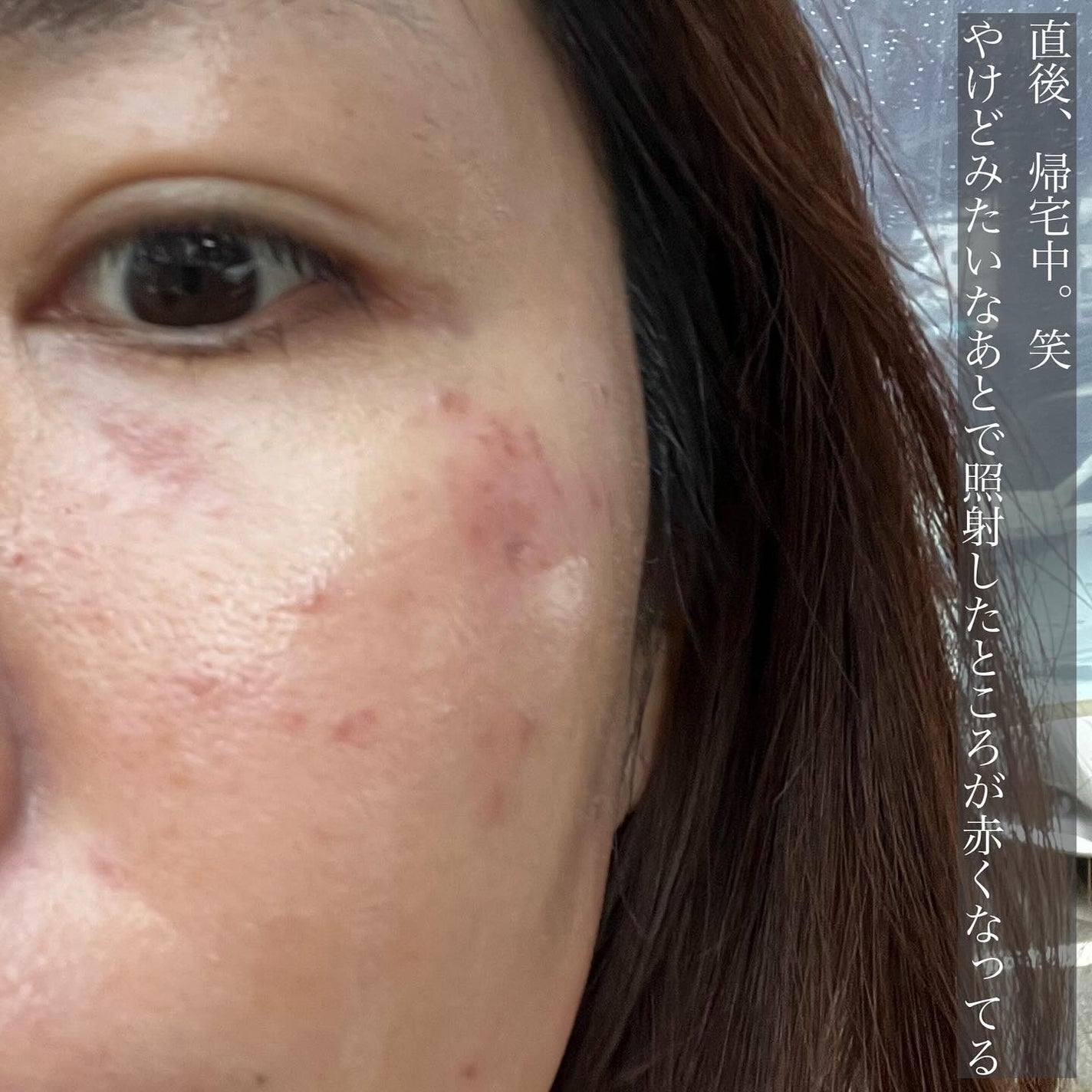 manað«§ãããã©ã§æ¥œãã倧人ã®çŸå®¹/ã³ã¹ã¡ on LIPS ãã·ãåãåäœéš//ã€ããã®åãåããŠã®ã·ãåãã¬ãŒã¶ãŒãããŠã..ãïŒ4æç®ïŒ