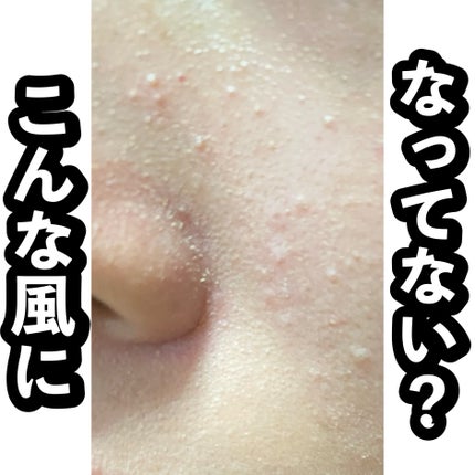 ヘルプミー! ダクトパッド/One-day's you/トナーパッドを使ったクチコミ(1枚目)