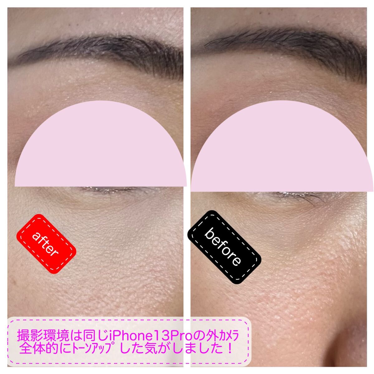 リキッドコンシーラー/Kirei&co./リキッドコンシーラーを使ったクチコミ(3枚目)