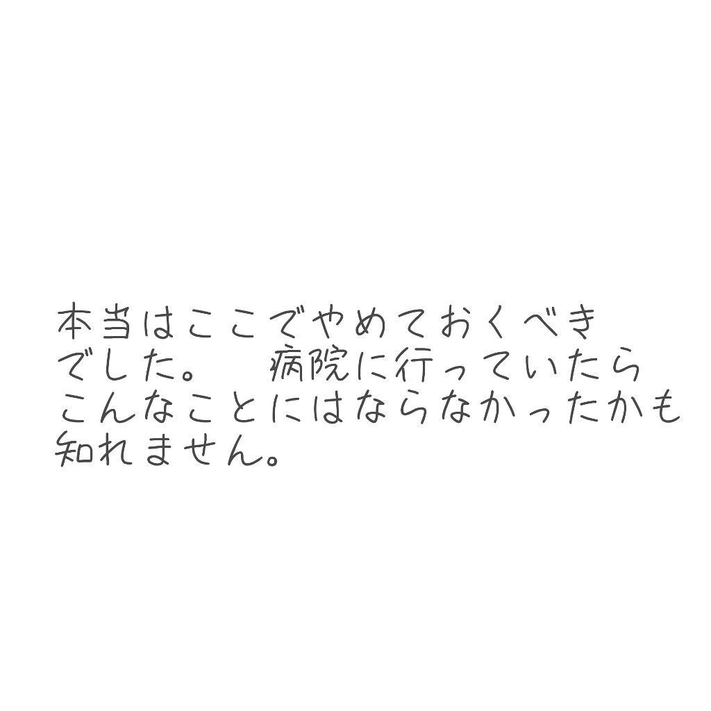 アイトーク スーパーホールド/アイトーク/二重まぶた用アイテムを使ったクチコミ(4枚目)
