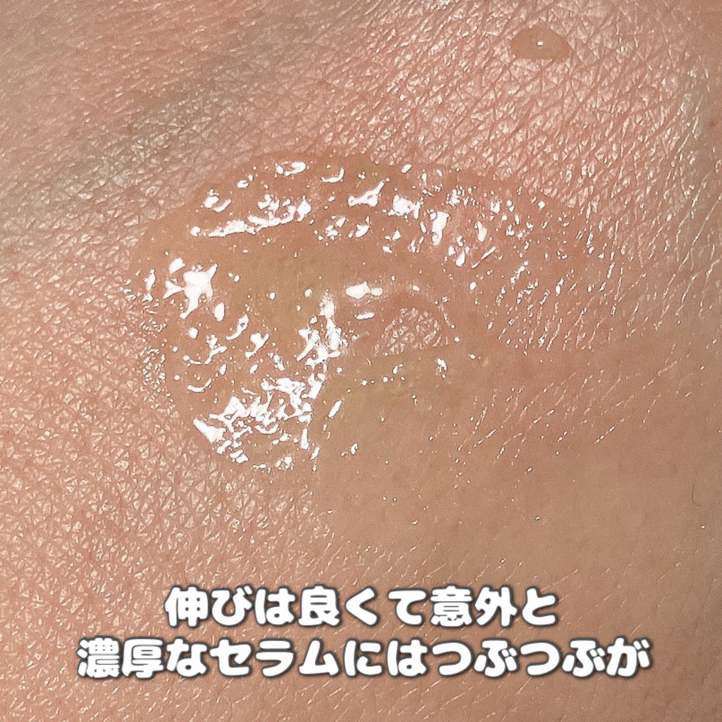 サンデーシカサンセラム/EDIT.B/美容液を使ったクチコミ(4枚目)