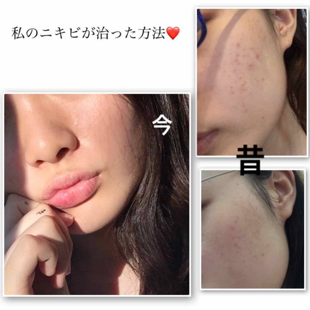 テイク ザ デイ オフ クレンジング バーム/CLINIQUE/クレンジングバームを使ったクチコミ（1枚目）