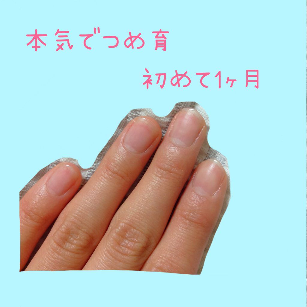 ウィンマックス キューティクルオイル/DAISO/ネイルオイル・トリートメントを使ったクチコミ（1枚目）