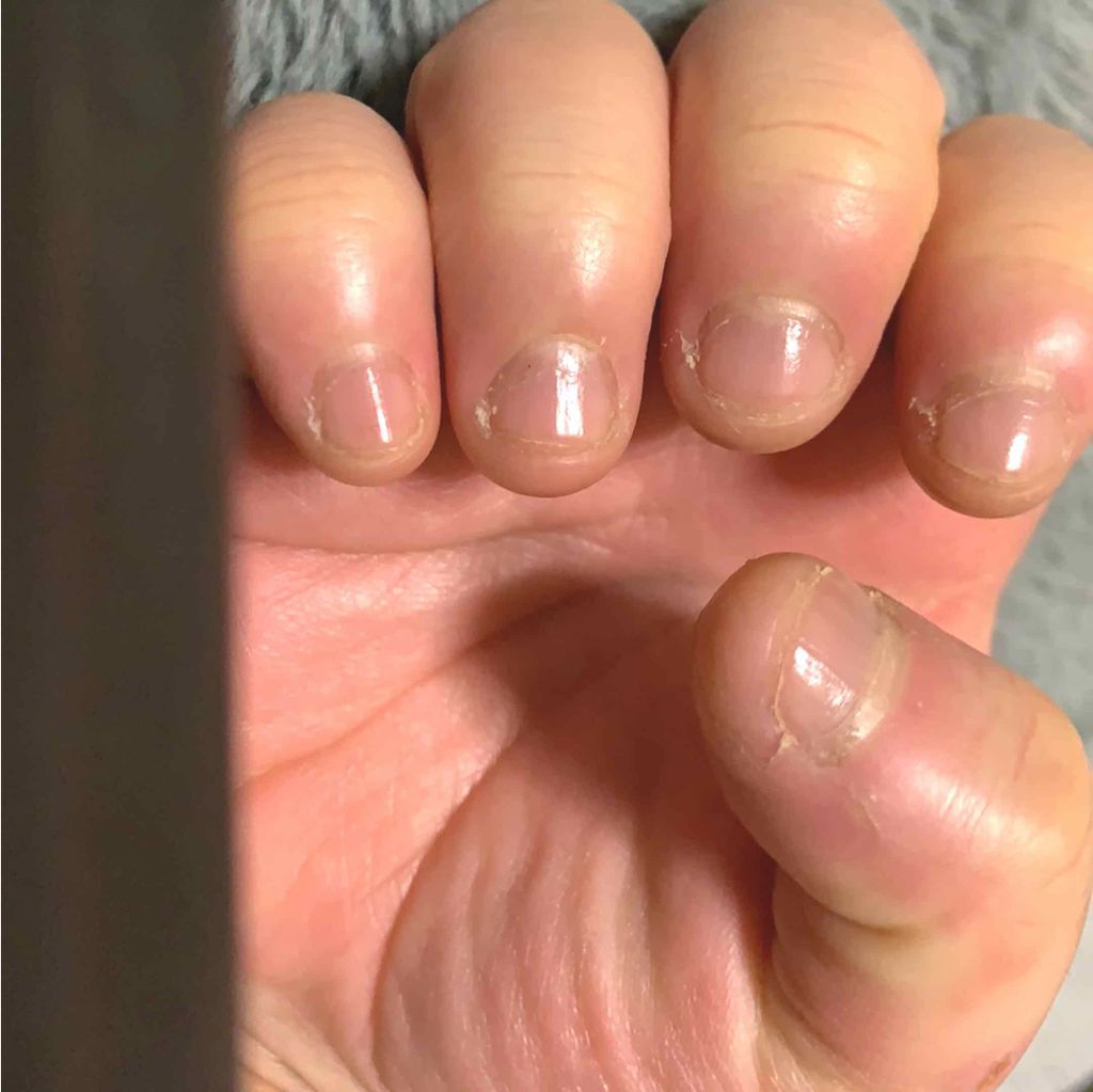 ネイルファンデーション パラドゥの口コミ 爪噛みの癖があるアラサー女です By たんれい 脱爪噛み 脂性肌 30代前半 Lips ネイルファンデーション パラドゥの口コミ 爪噛みの癖があるアラサー女です By たんれい 脱爪噛み 脂性肌 30代前半 Lips