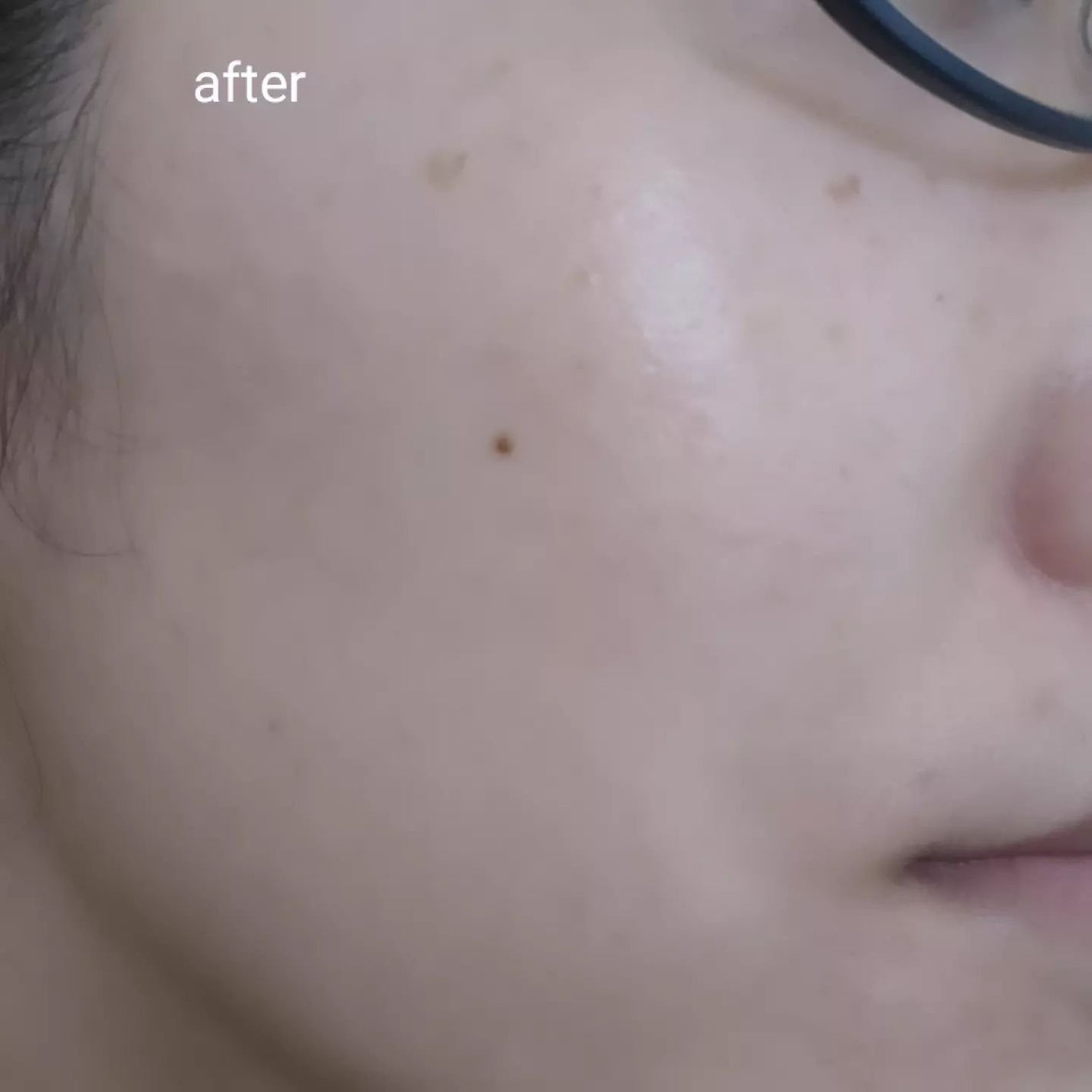 ゼロ1DAYエクソソームショット2000/MEDICUBE/美容液を使ったクチコミ(5枚目)