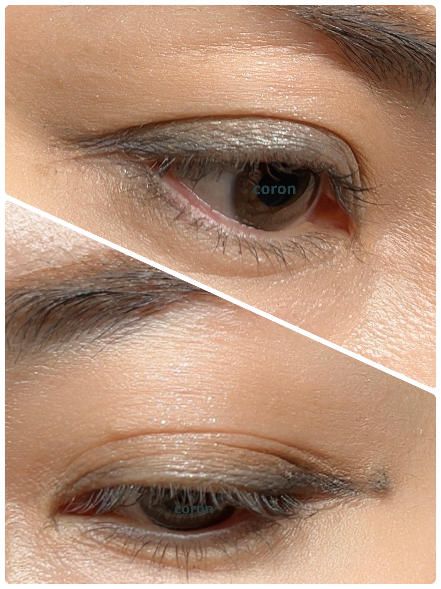 ããŒãã§ã¯ããšã¯ã¹ãã³ã·ã§ã³ ãã¹ã«ã©/D-UP/ãã¹ã«ã©ã䜿ã£ãã¯ãã³ãïŒ2æç®ïŒ