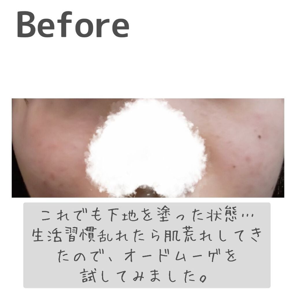 オードムーゲ 薬用ローション(ふきとり化粧水)/オードムーゲ/拭き取り化粧水を使ったクチコミ(3枚目)