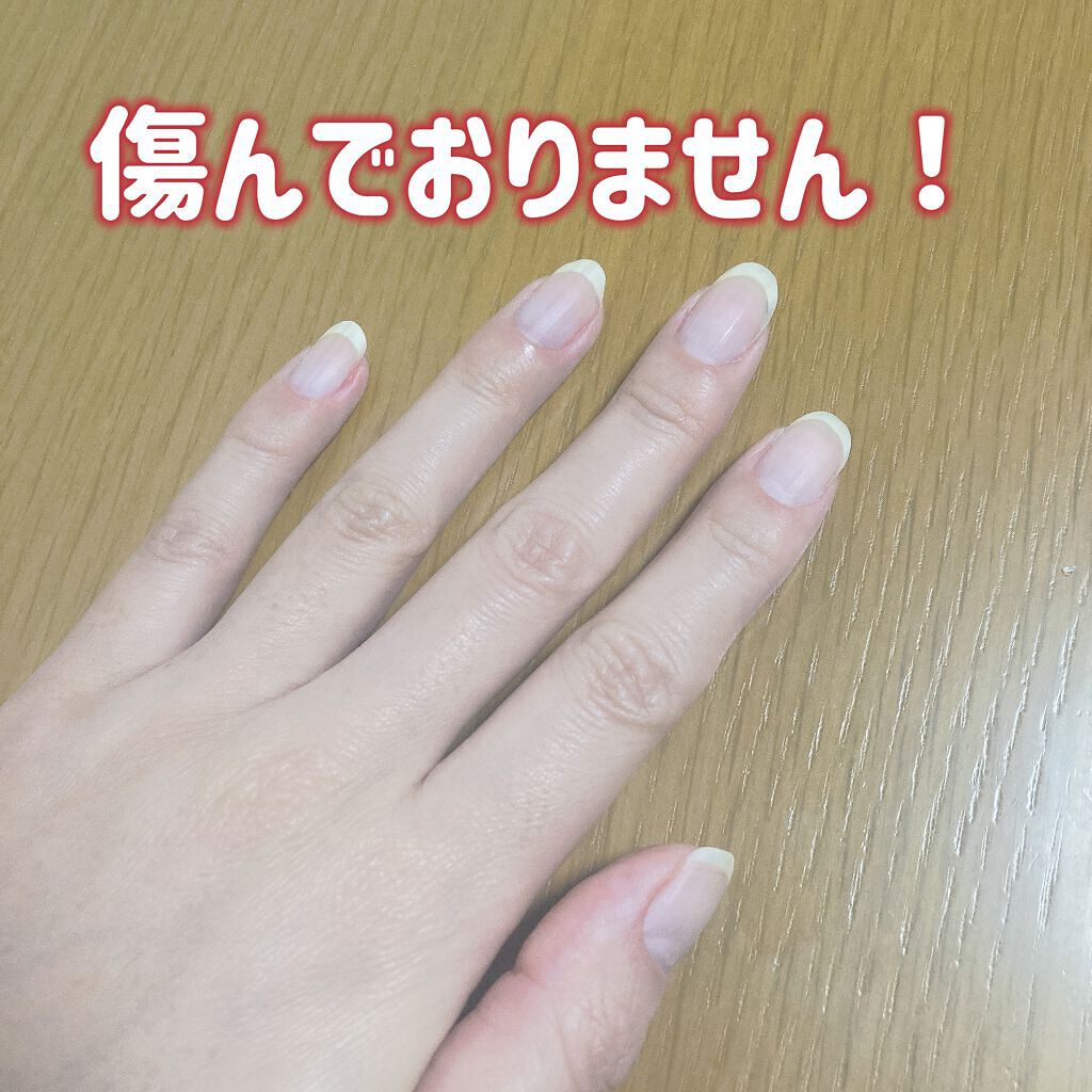 ネイルエンビー/O・P・I/ネイルオイル・トリートメントを使ったクチコミ（3枚目）