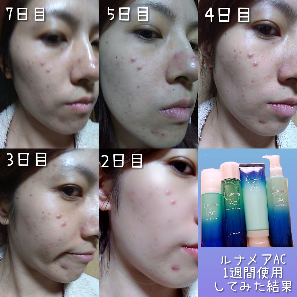 ファイバーフォーム/ルナメアAC/洗顔フォームを使ったクチコミ(1枚目)