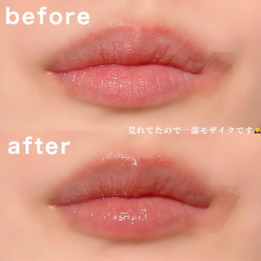 寝ている間にリップケア♡黒のリップバーム！
ーーーーーーーーーーーー
unpa
Bubi Bubi Lip Mask
(ブビブビ リップマスク)
1,650円（税込）容量：9g
ーーーーーーーーーーーー

刺激を与えずに寝ている間に保湿、シワ改善、荒れも落ち着かせてくれる♡

抗酸化成分の豊富な西洋いちごエキス、黒米エキスなどで作られたブラックフードコンプレックスにアデノシンを加え唇のシワを集中ケアしてくれるそう。

私の唇は皮が剥けやすく、荒れやすいのがほんっとに悩みで…
一日中何度もリップクリームをぬりぬりぬりぬり。笑

朝と夜のリップマスクでリップクリームを塗る回数が減って嬉しい♡

メイクをする日はスキンケアの段階でこのリップマスクを使うことでしっかりケア♡

愛用リップケアの仲間入りです！

#unpa #オンパ #韓国コスメ #リップケア #唇ケア #ぷりぷり唇 #リップボリューム #唇シワ改善 #水分たっぷり #提供 #ガチレビュー の画像 その2