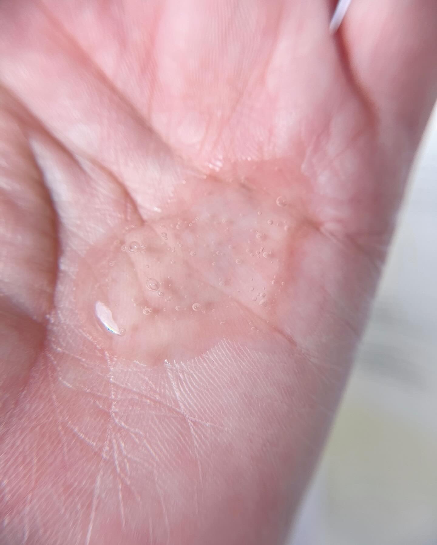 プロダーマ弱酸性ジェルクレンザー/DERCENT/洗顔フォームを使ったクチコミ（3枚目）