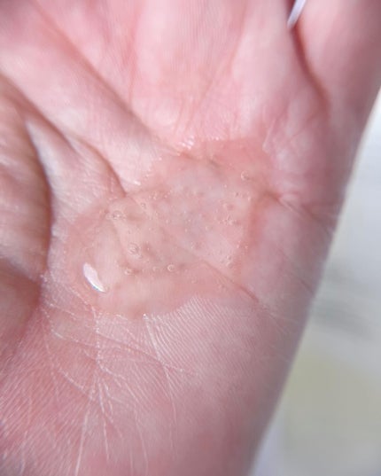 プロダーマ弱酸性ジェルクレンザー/DERCENT/洗顔フォームを使ったクチコミ(3枚目)