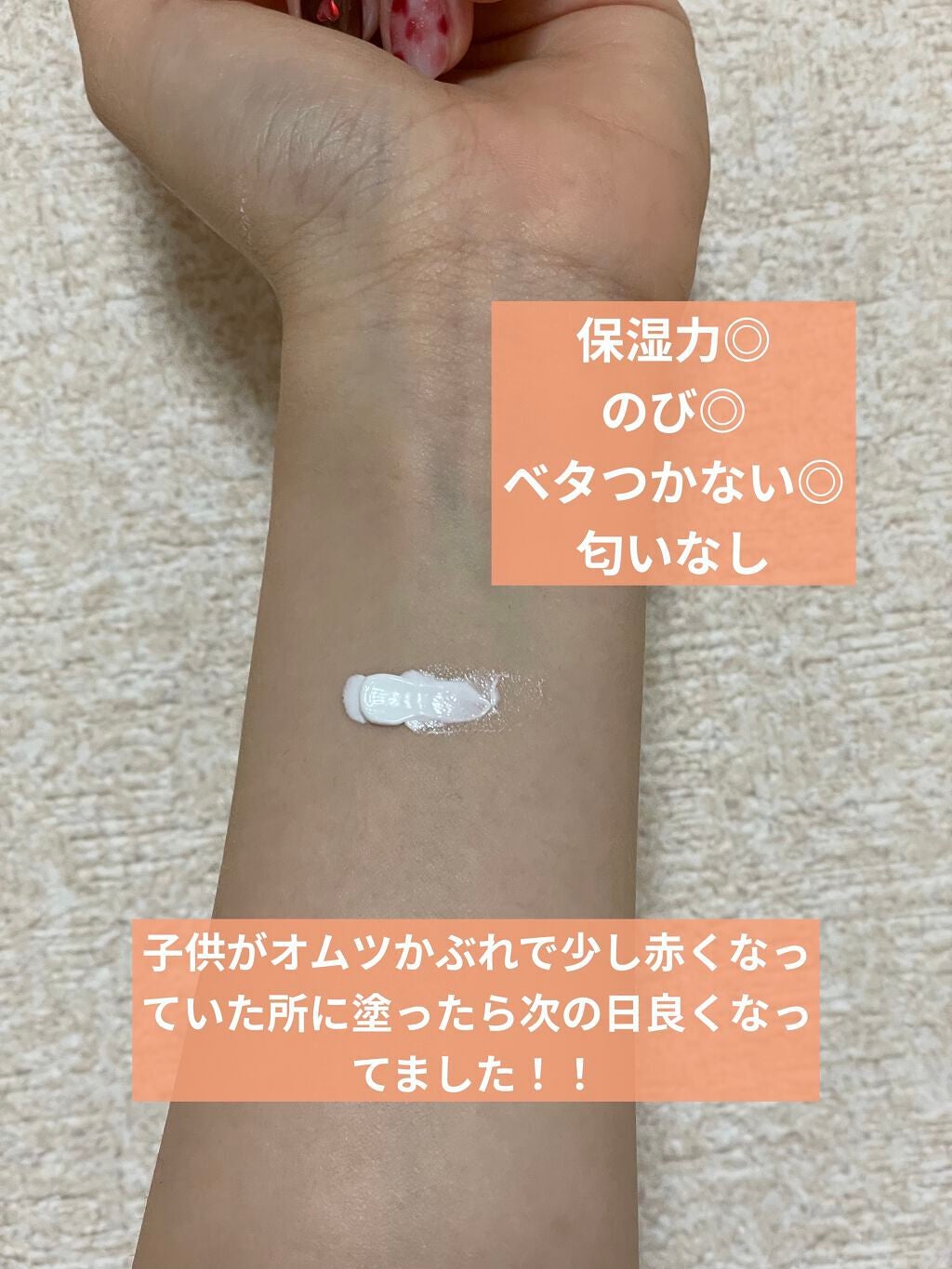 シカルファットプラス リペアクリーム/アベンヌ/フェイスクリームを使ったクチコミ(2枚目)