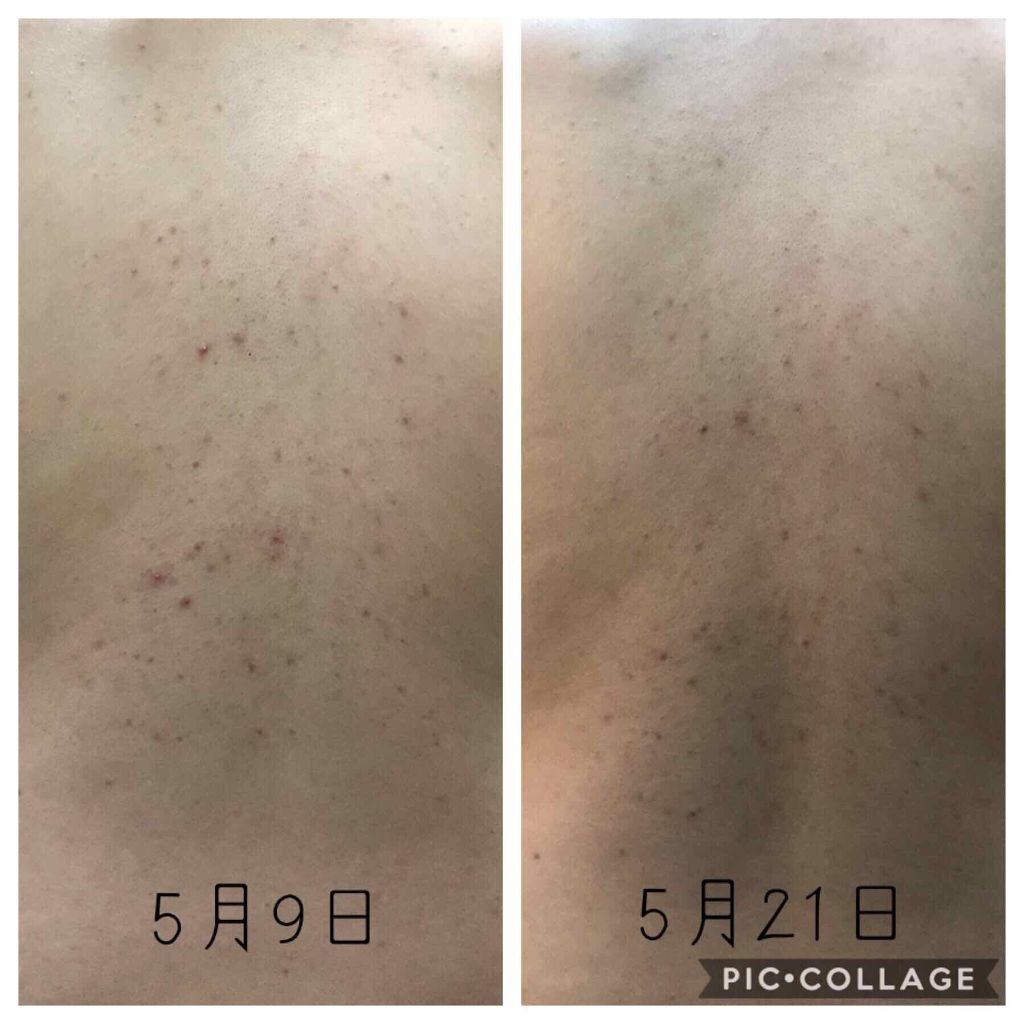 薬用スキンコンディショナー/オードメディカ/ボディローションを使ったクチコミ（2枚目）