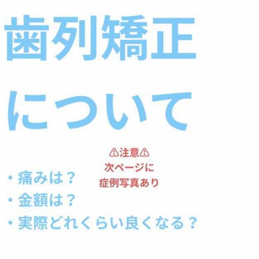 マウスピース矯正/その他を使ったクチコミ（1枚目）