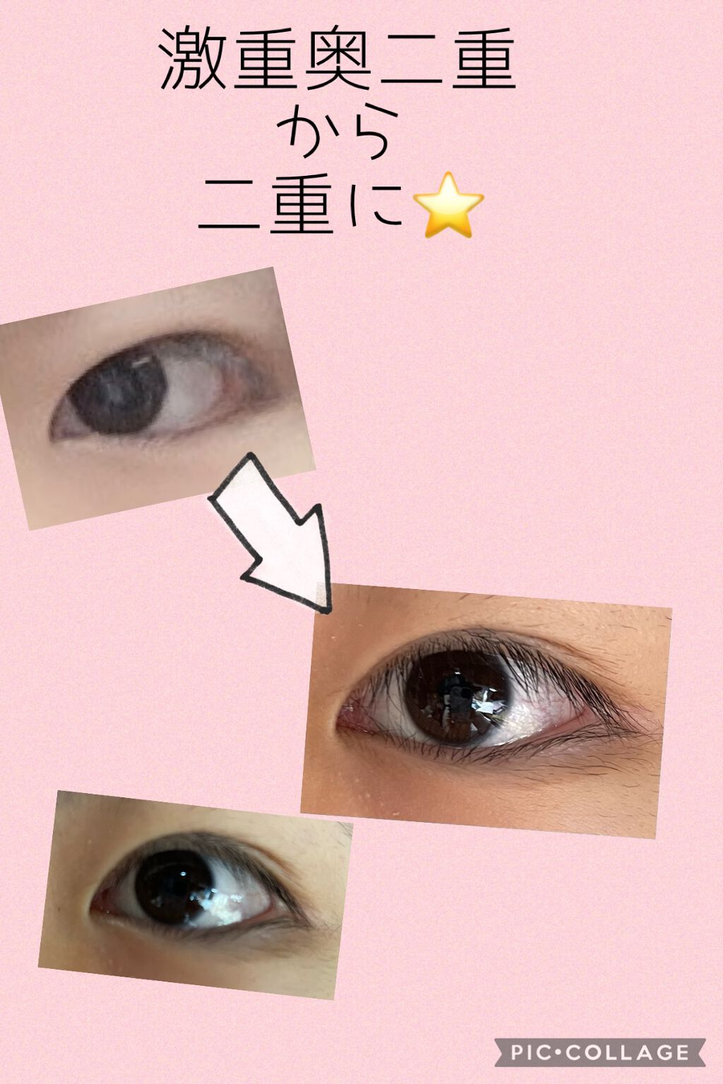 二重まぶた用シール レギュラー/DAISO/二重まぶた用アイテムを使ったクチコミ(1枚目)