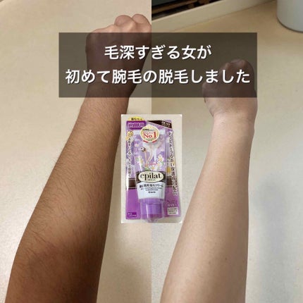 除毛クリームキット敏感肌用/エピラット/除毛クリームを使ったクチコミ(1枚目)