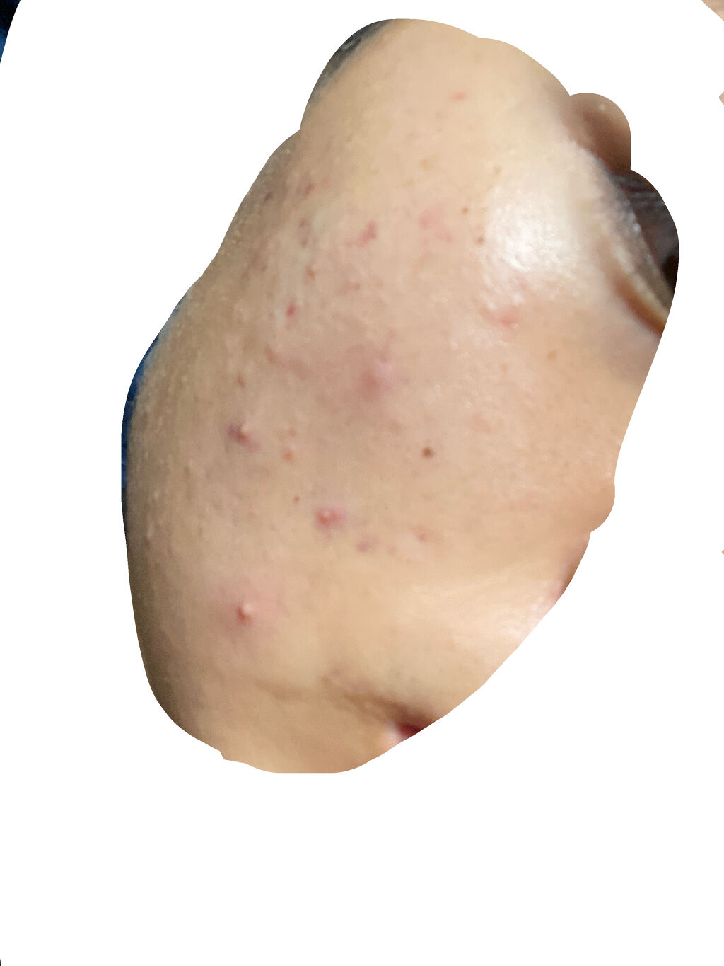 明色美顔水 薬用化粧水/美顔/化粧水を使ったクチコミ（2枚目）