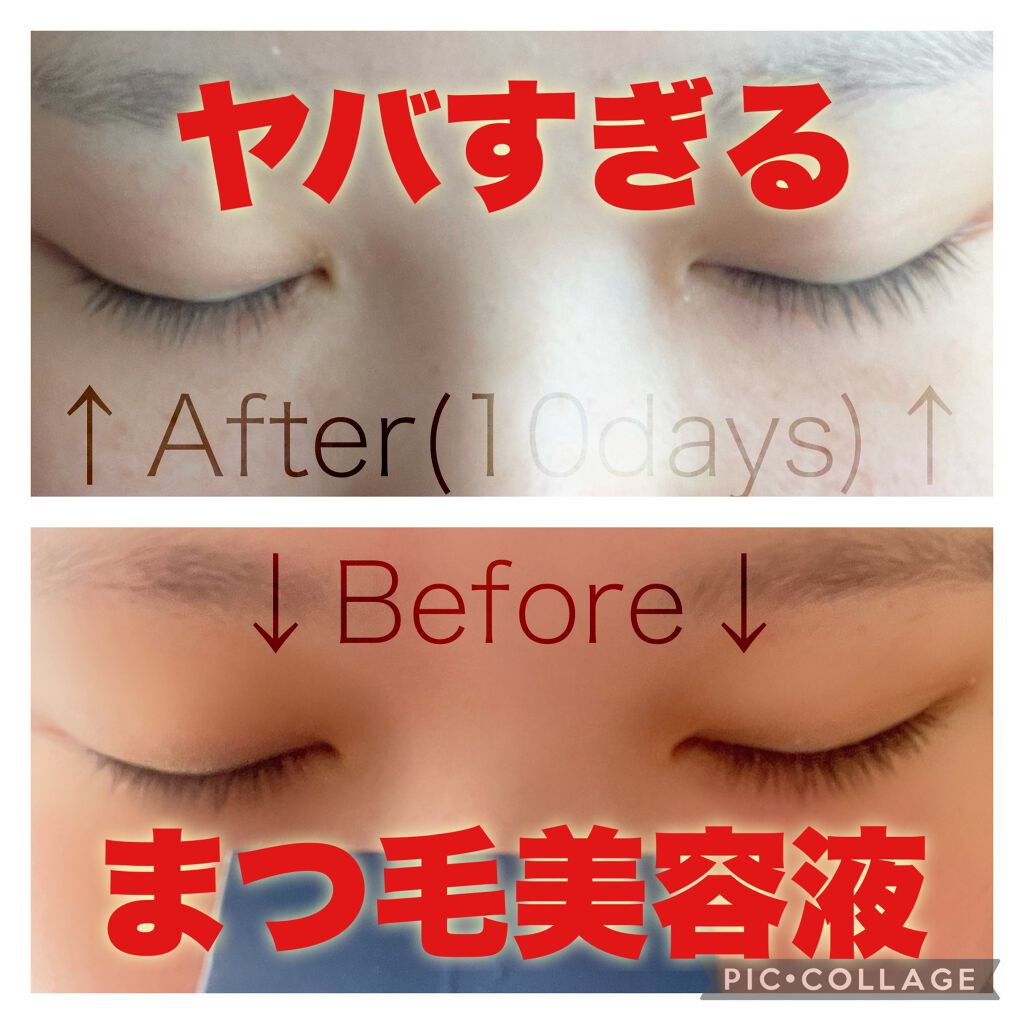 リバイタラッシュ アドバンス ジャパン/エム・アール・アイ/まつげ美容液を使ったクチコミ(1枚目)