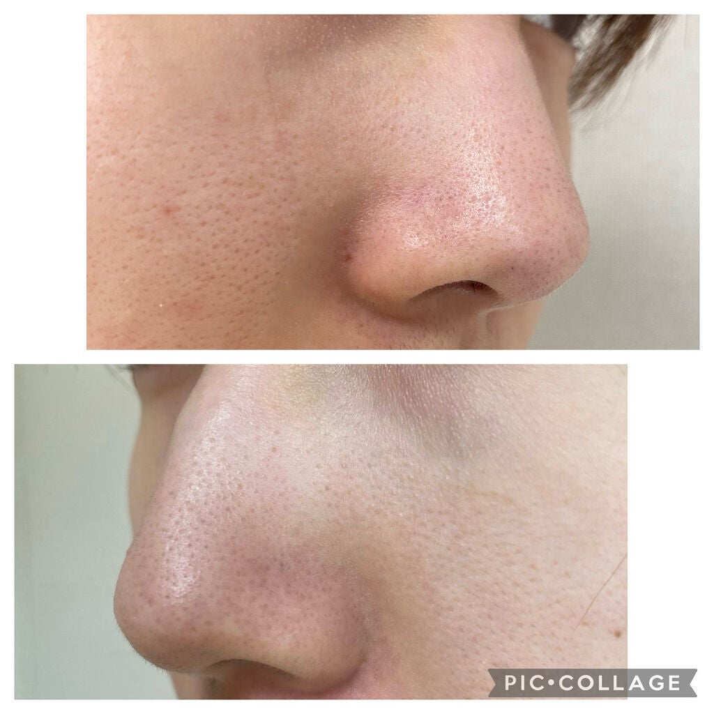 ノーモアブラックヘッド(ノーズピーリング)/One-day's you/スクラブ・ゴマージュを使ったクチコミ(3枚目)