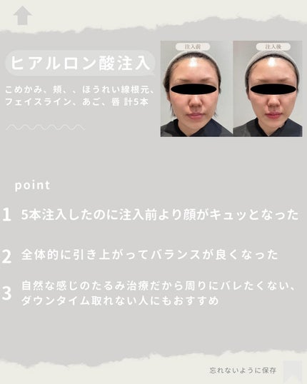 ディレイア ゼル/Direia/美顔器・マッサージを使ったクチコミ(3枚目)
