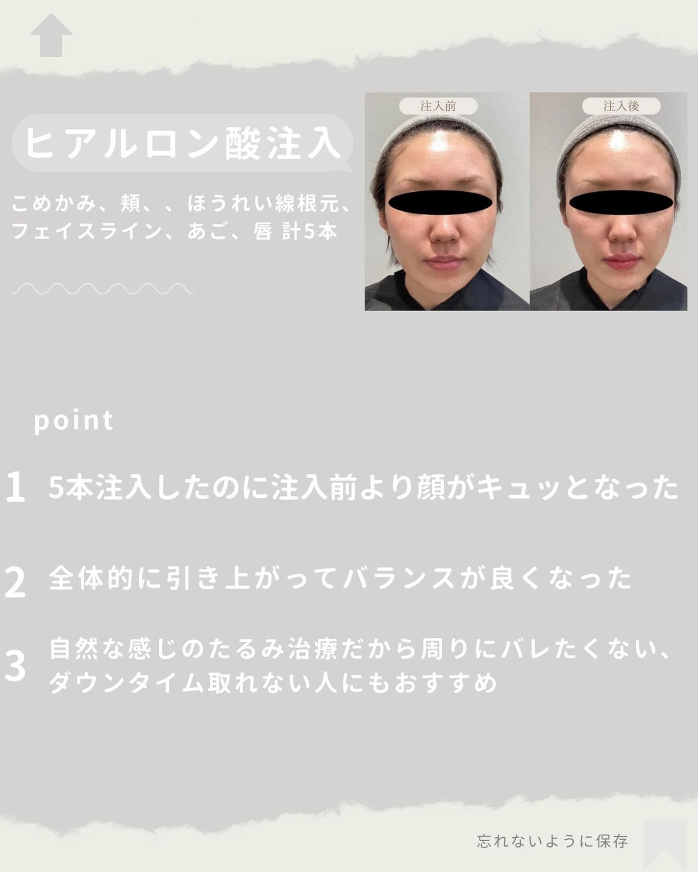試してみた】ディレイア ゼル Direiaのリアルな口コミ・レビュー 試してみた】ディレイア ゼル Direiaのリアルな口コミ・レビュー