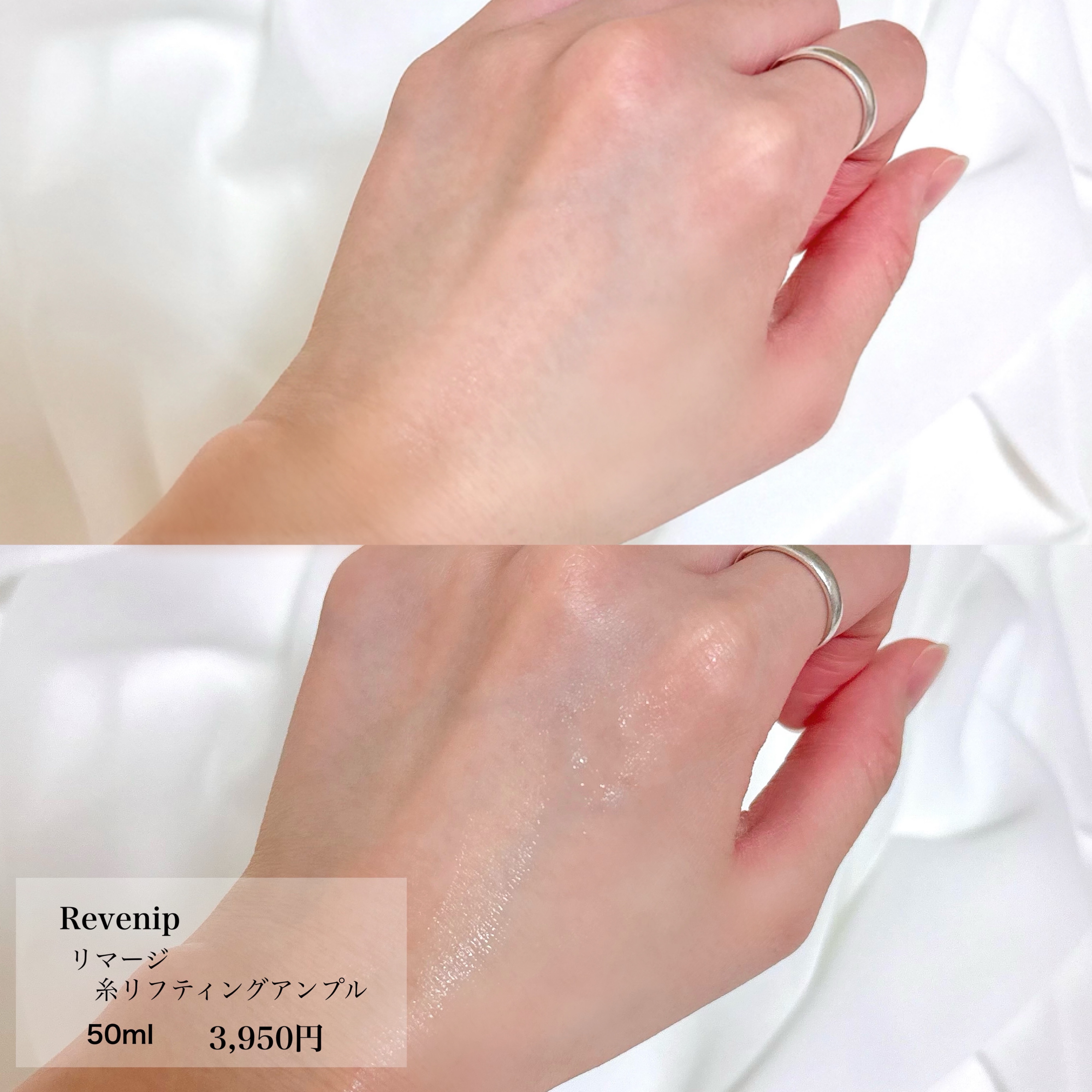 リマージ糸リフティングアンプル/REVENIP/美容液を使ったクチコミ（3枚目）