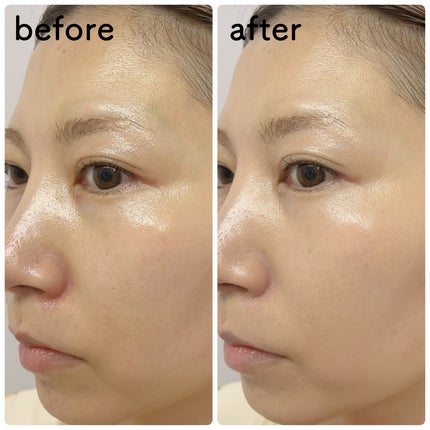 エッグライククッション/freshian/クッションファンデーションを使ったクチコミ(8枚目)