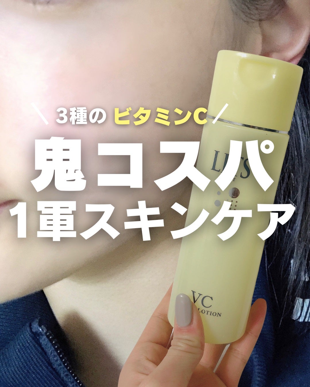 モイスト ローションC/リッツ/化粧水を使ったクチコミ(1枚目)