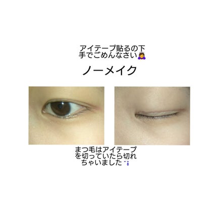 のびーるアイテープ(絆創膏タイプ、レギュラー)/DAISO/二重まぶた用アイテムを使ったクチコミ(2枚目)
