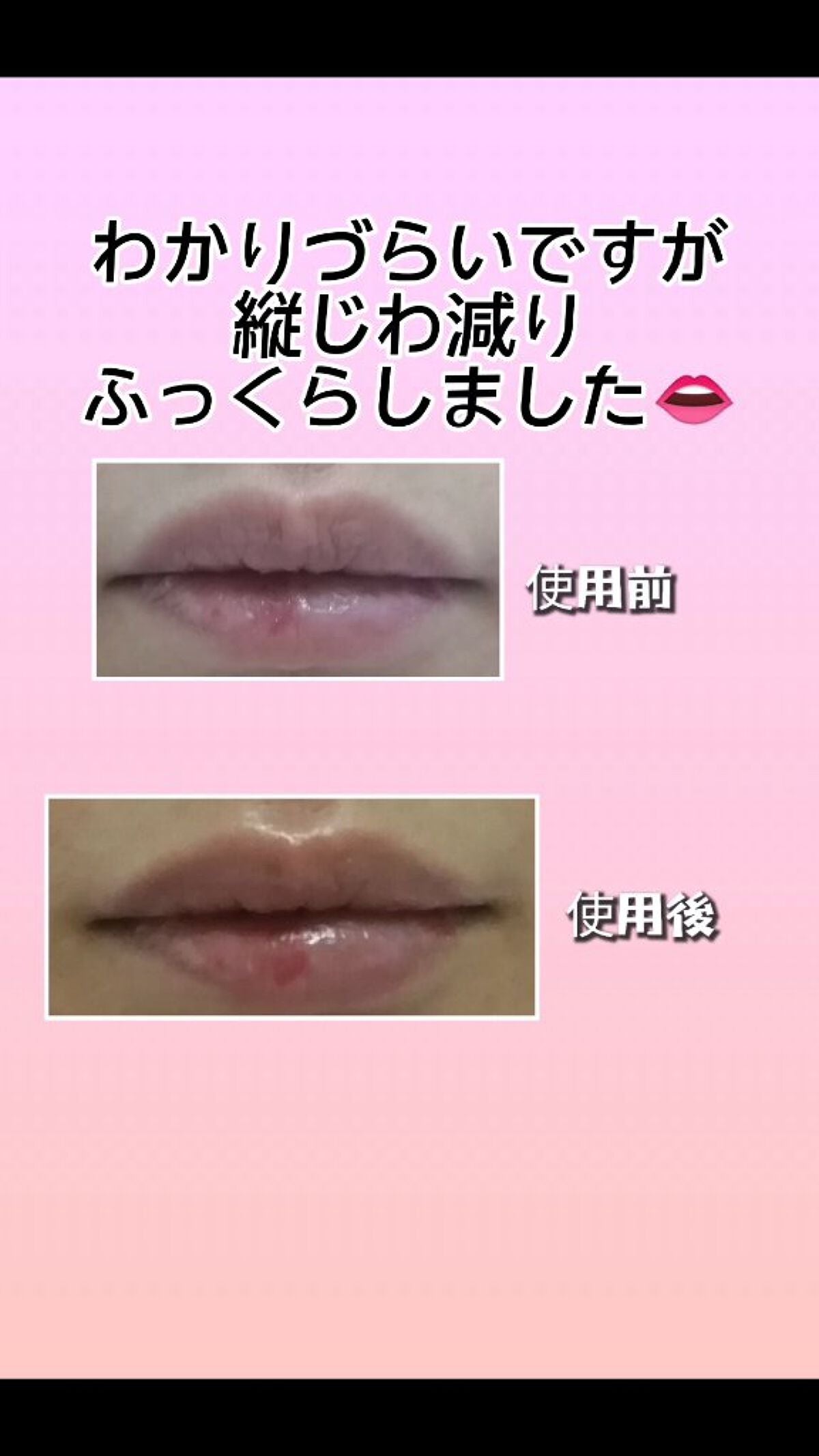 Qoo10/Qoo10/シートマスク・パックを使ったクチコミ(6枚目)