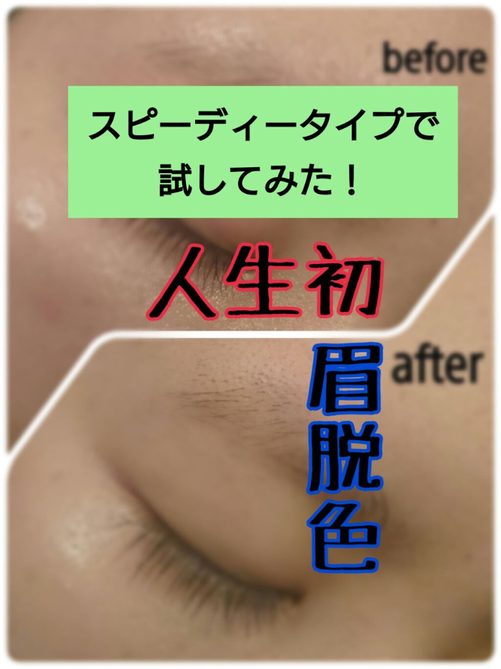 脱色クリーム スピーディー/エピラット/ムダ毛ケアを使ったクチコミ（1枚目）