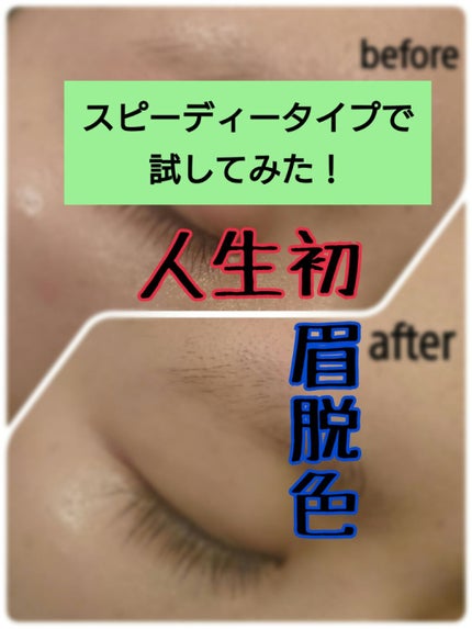 脱色クリーム スピーディー/エピラット/ムダ毛ケアを使ったクチコミ(1枚目)