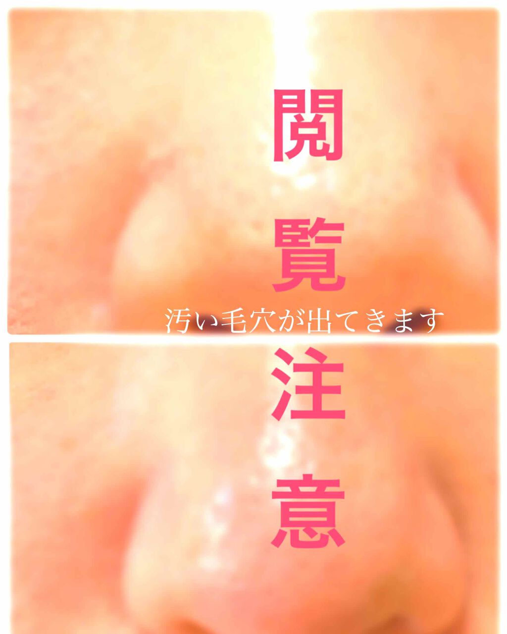 ノーモアブラックヘッド(ノーズピーリング)/One-day's you/スクラブ・ゴマージュを使ったクチコミ(1枚目)