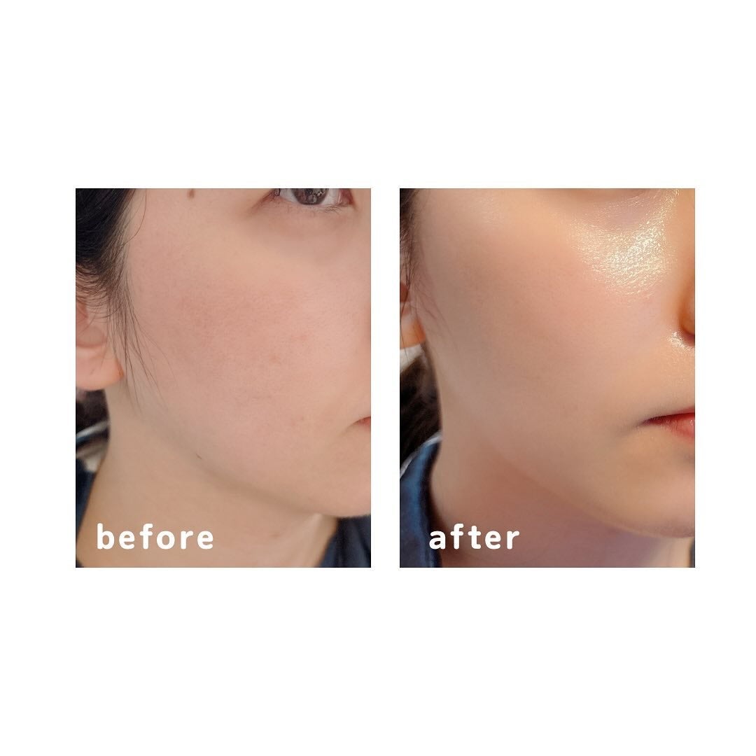 9番 NMNバイオリフトラッピングマスク/numbuzin/シートマスク・パックを使ったクチコミ(6枚目)