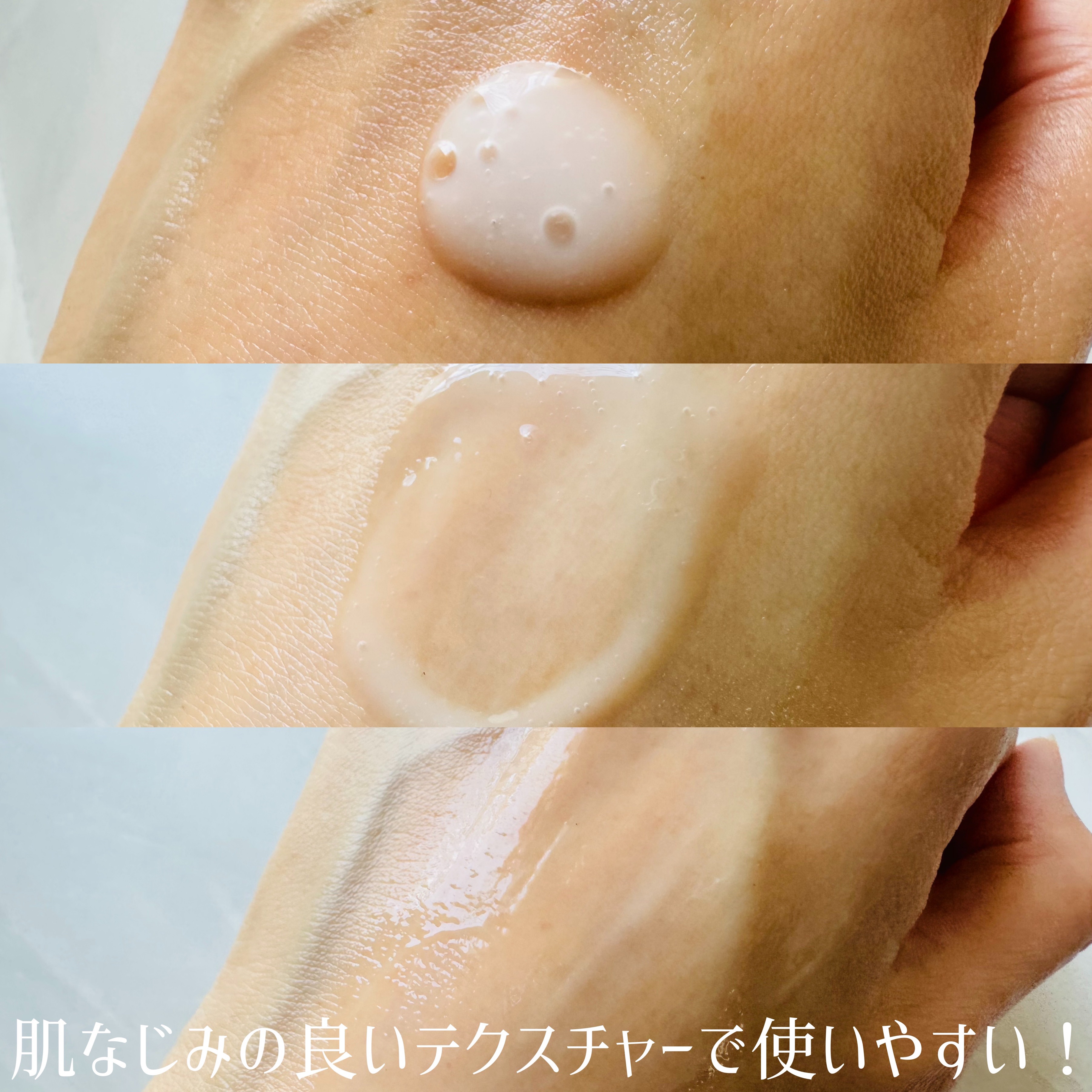 ニードルセラムA/fractionalCC/美容液を使ったクチコミ（2枚目）